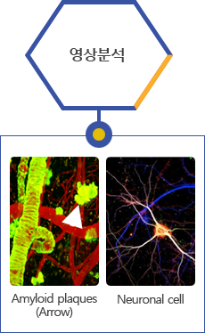 영상분석:Amyloid plaques(Arrow),Neuronal cell
